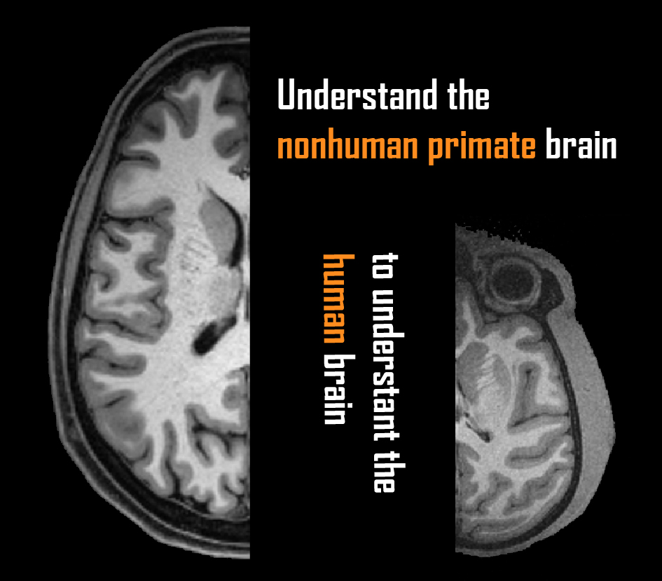 MRI images of a human brain and of a nonhuman primate brain