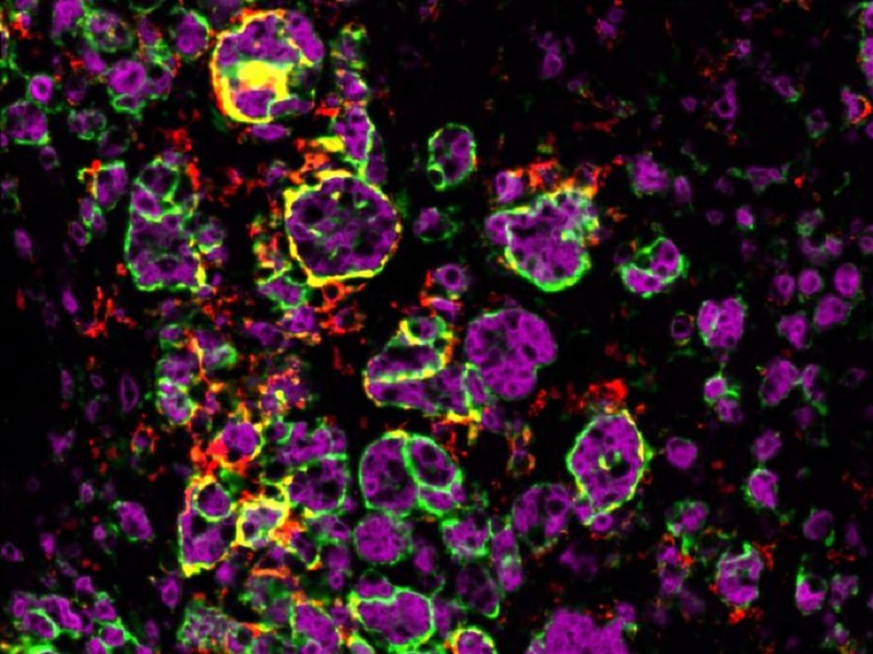 Macrophages attaquant la tumeur surrénalienne d’une souris mâle. 