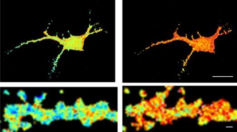 Alzheimer's disease : how amyloid aggregates alter neuronal function