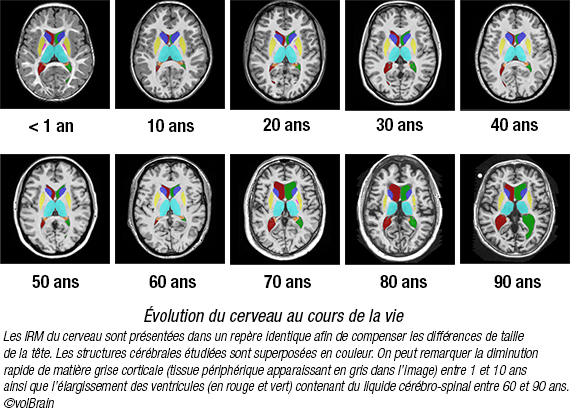 évolution du cerveau au cours de la vie 