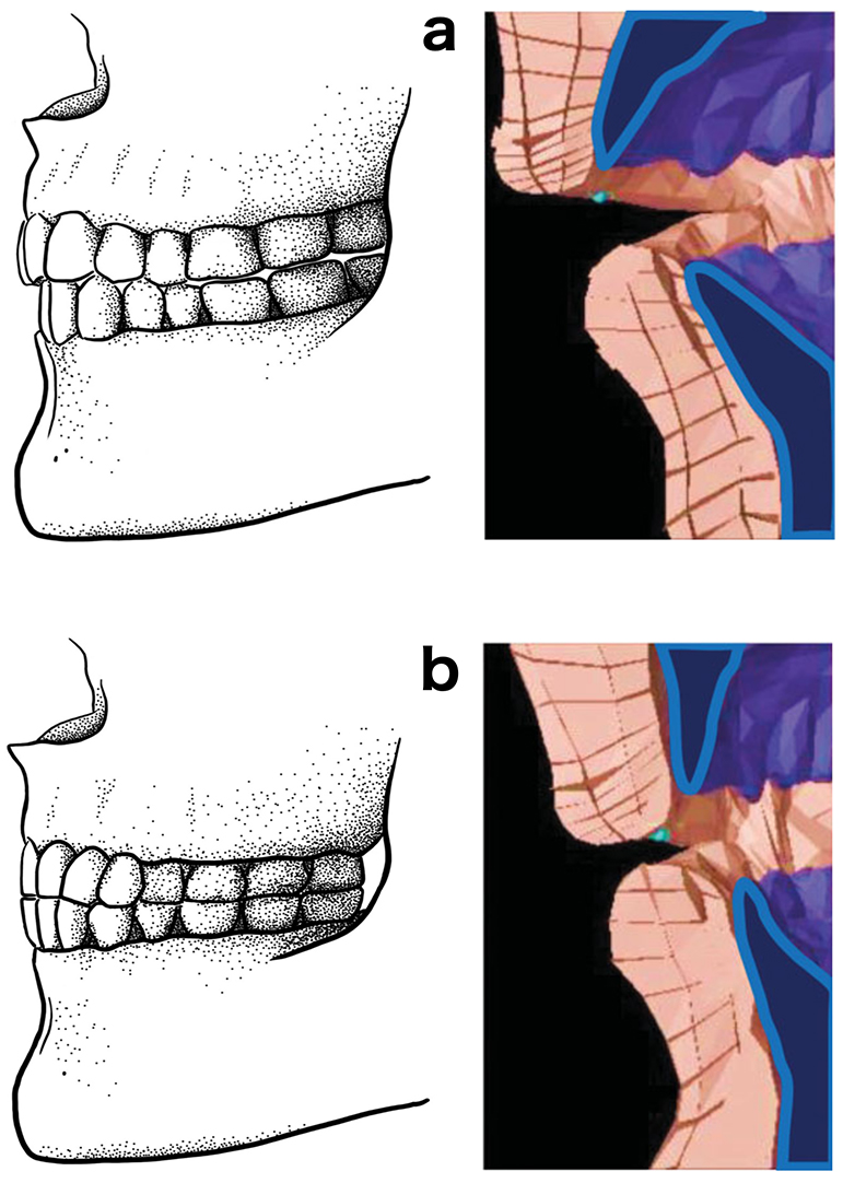 drawing and "stop frame" of a biomechanical model