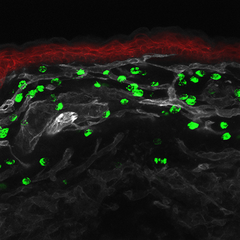 mast cells in skin 