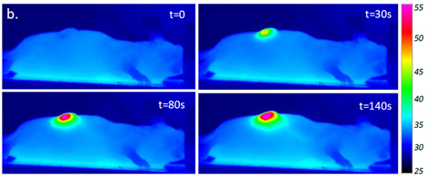 nanohyperthermie