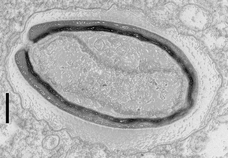 Pandoravirus quercus, trouvé à Marseille. 