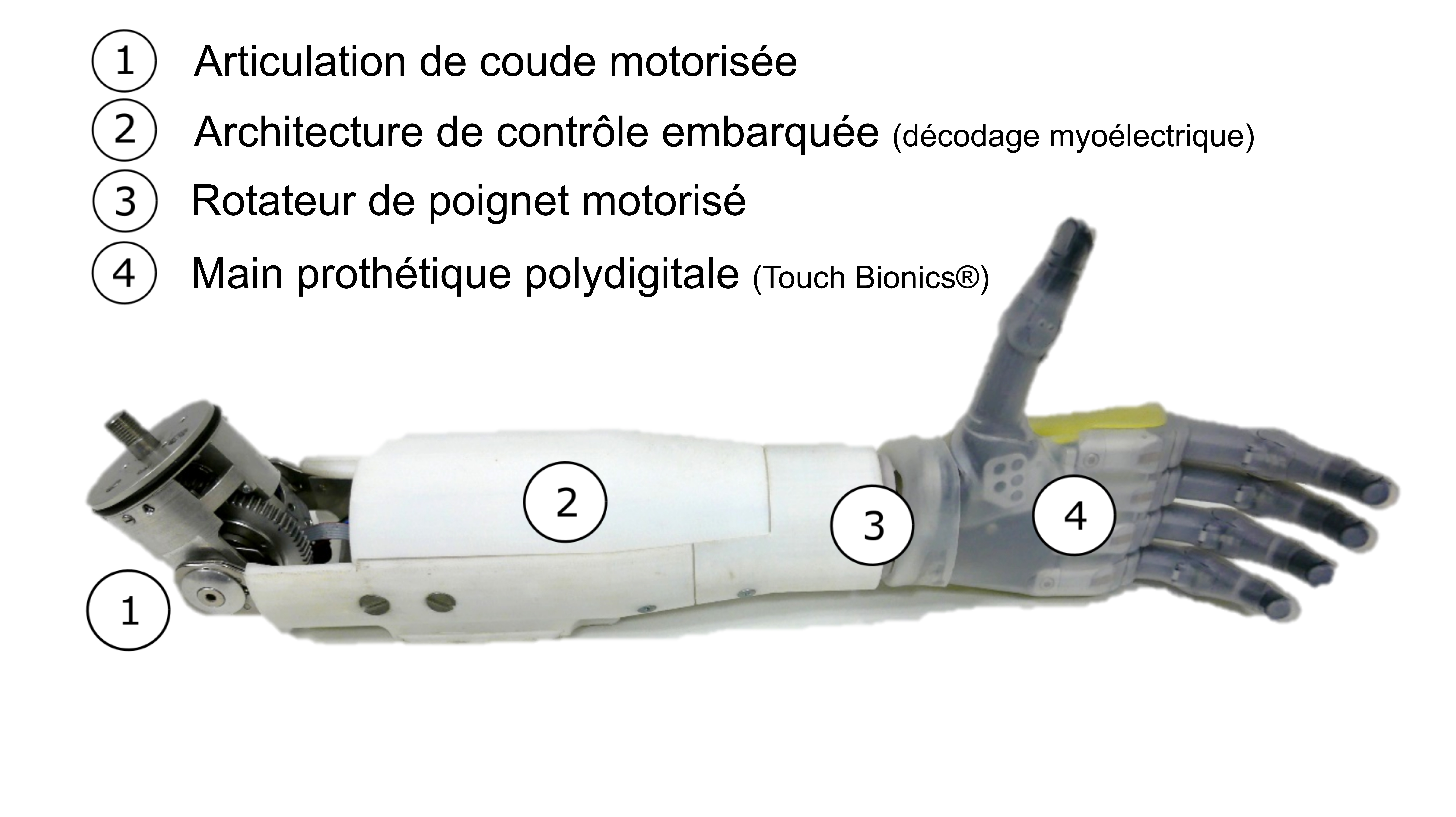 Descriptif prothèse