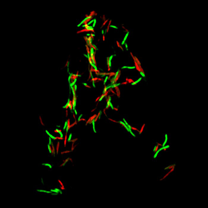 bacteria with fluorescent tags, observed under a microscope. 