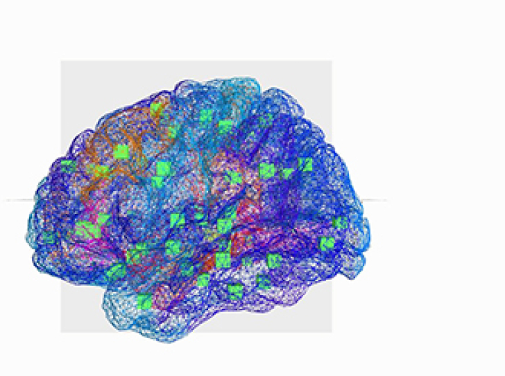 A virtual brain helps decrypt epilepsy