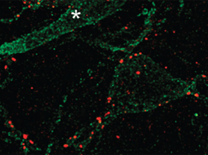 Optical control of a neuroreceptor alleviates chronic pain