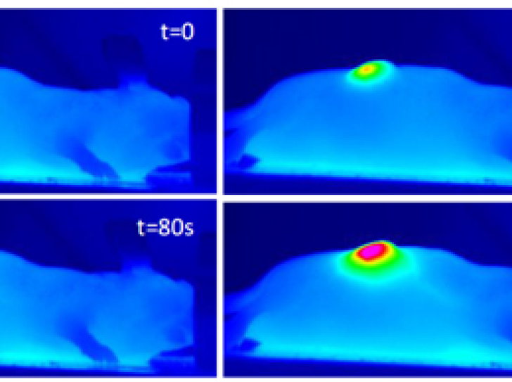 Nanohyperthermia softens tumors to improve treatment