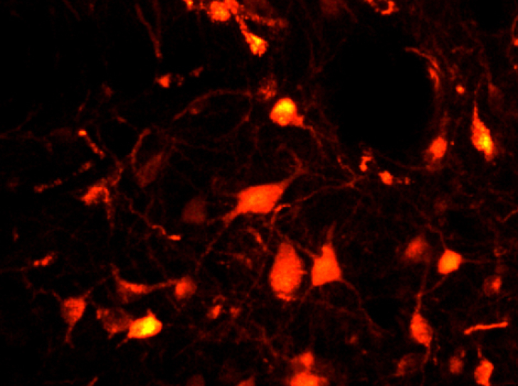 Sommeil paradoxal : ces neurones qui nous paralysent