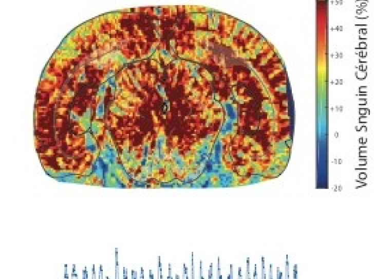 Cerveau sommeil paradoxal