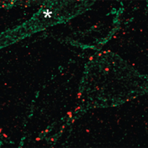 Optical control of a neuroreceptor alleviates chronic pain