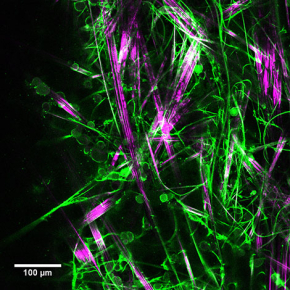 A new gelling molecule for growing neurons in 3D