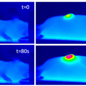 Nanohyperthermia softens tumors to improve treatment